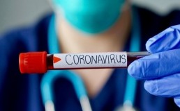 Коронавирусная инфекция – COVID 19